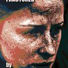 Half-way Fractured